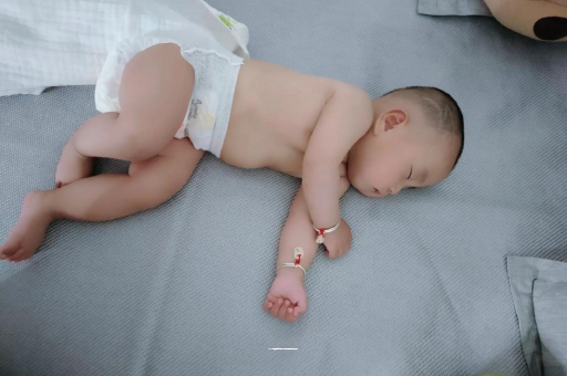 玉溪宝宝褶皱处擦粉还是油